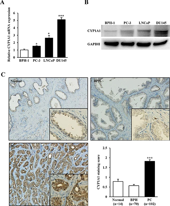 CYP1A1 expression in prostate cancer cell lines and tissues.