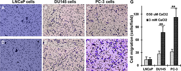 Effect of Cao2+ on the migration of LNCaP, DU145 and PC-3 cells.