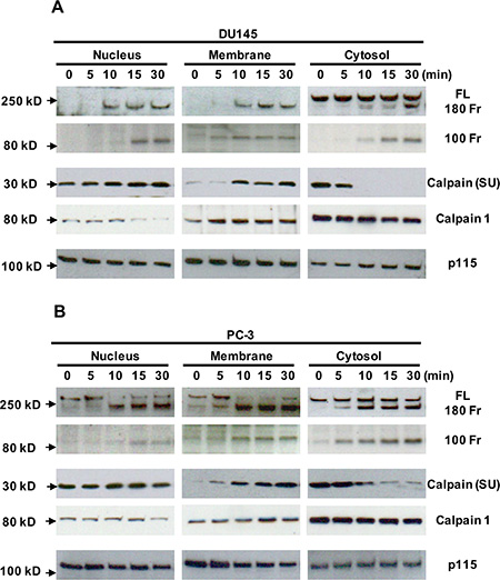 Translocation of calpain and filamin A fragments in Cao2+-treated DU145 and PC-3 cells by cellular fractionation.