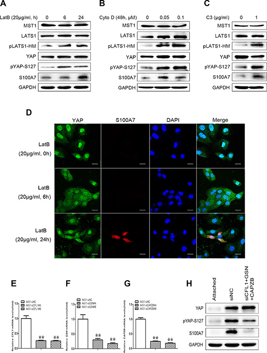 S100A7 induction is mediated by YAP via the actin cytoskeleton reorganization.