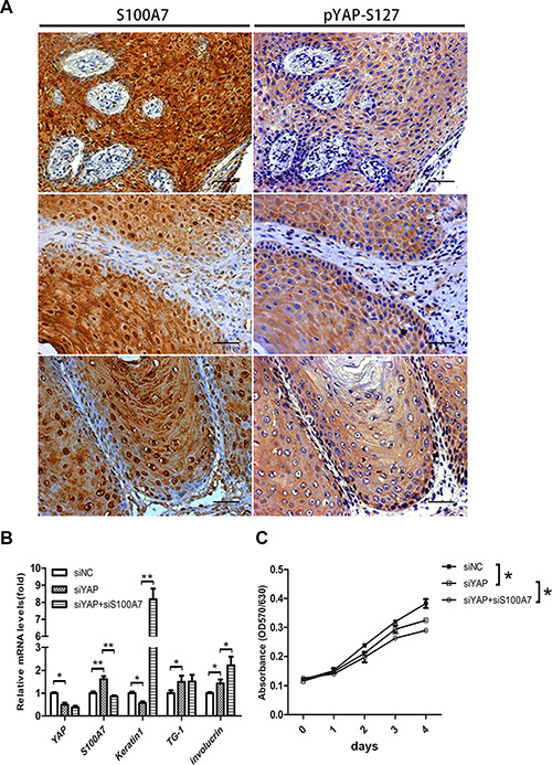Identification of S100A7 and pYAP-S127 expression in skin SCC tissues, and loss of YAP and S100A7 leads to cell differentiation and growth inhibitions.