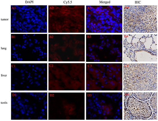NIRF of Cy5.5-Tf-DTPA-Gd probe in tumor tissue and transferrin receptor expression in tumor cells.