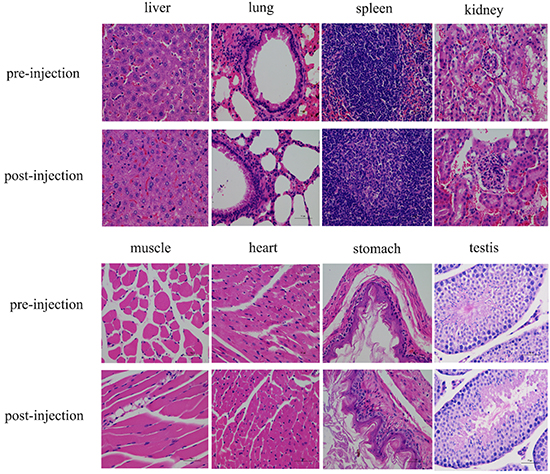 HE staining of main organs with or without injection of Cy5.5-Tf-DTPA-Gd.