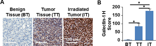 Radiation augmented galectin-1 expression in orthotopic tumors originating from TTA.