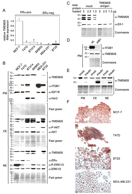 TMEM26 RNA and protein are expressed in ER&#x03B1;-positive and -negative breast cancer cell lines.