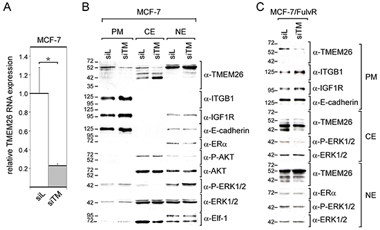 Knock-down of TMEM26 leads to changes in TMEM26 protein expression and to an increase in the integrin &#x03B2;1 level.