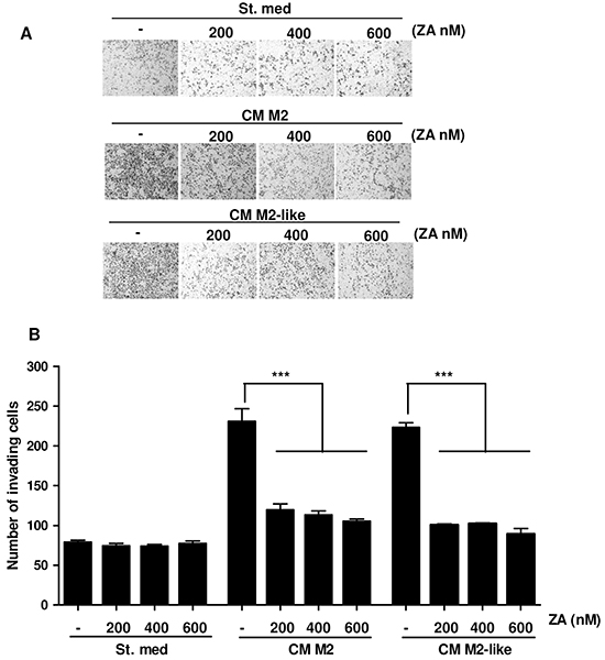 M2 and M2-like macrophages-dependent increase of PC3 cells invasiveness is impaired by ZA treatment.