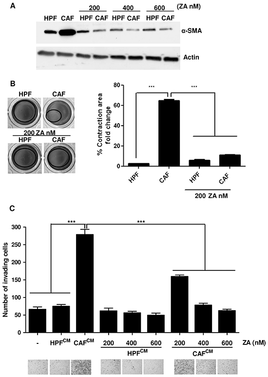 ZA administration reverts CAF activation and impairs their pro-invasive effects on cancer cells