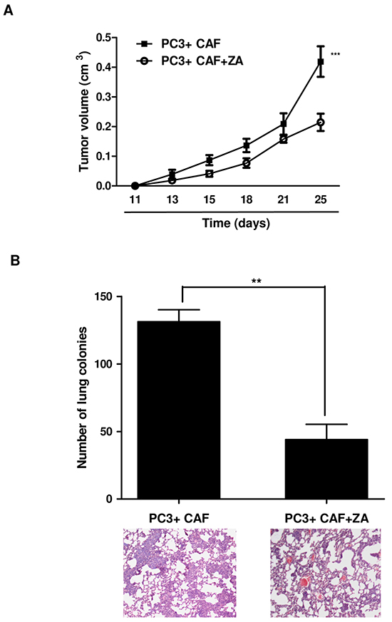 ZA in vivo administration prevents tumor growth and lung metastatic dissemination.