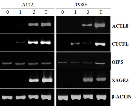 RT-PCR for