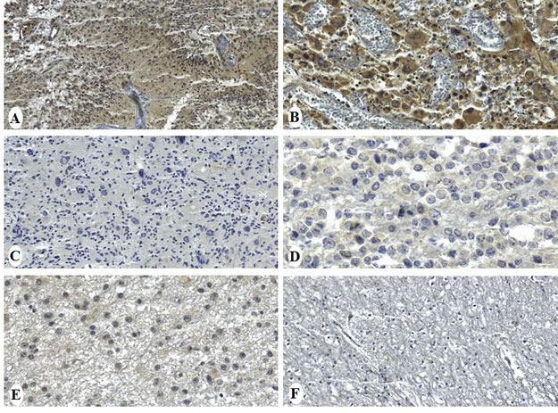 Immunohistochemical staining of