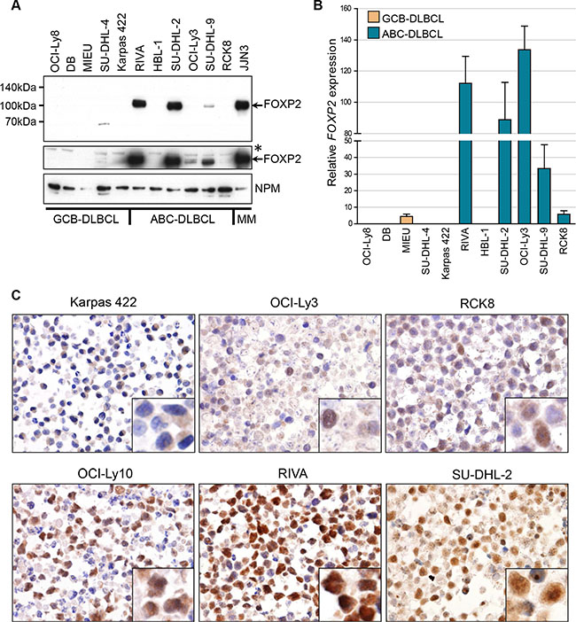 FOXP2 is expressed in ABC-DLBCL cell lines.