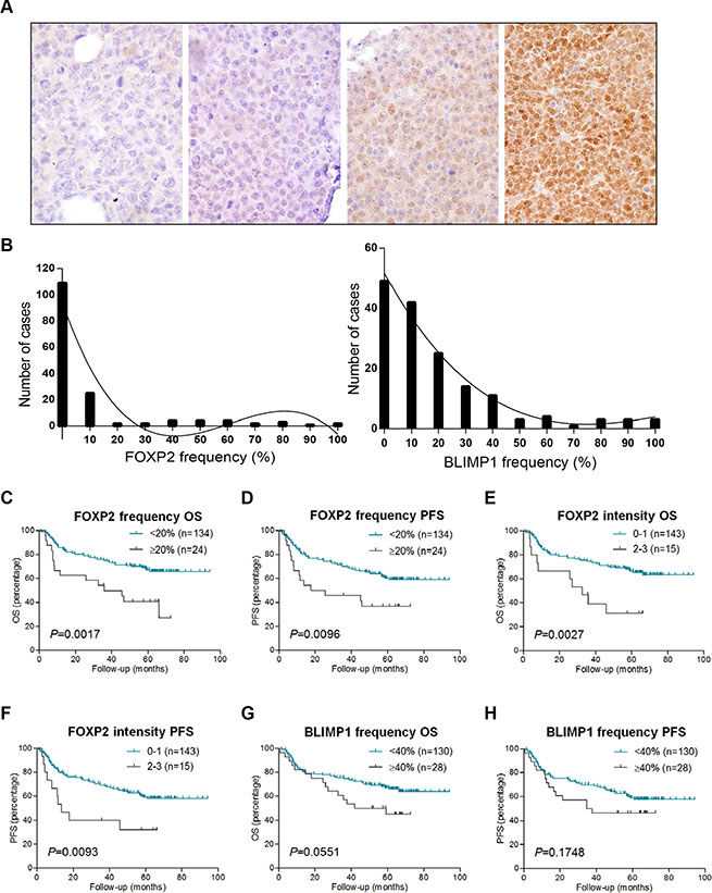 FOXP2 expression confers inferior survival in R-CHOP-treated DLBCL cases.