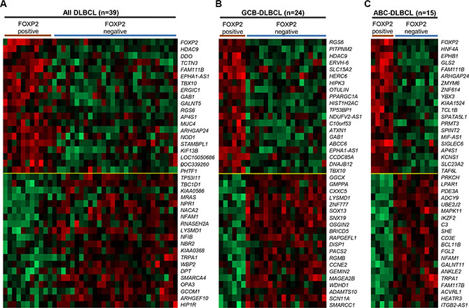 Genes most highly-correlated with FOXP2 protein expression in primary DLBCL cases.