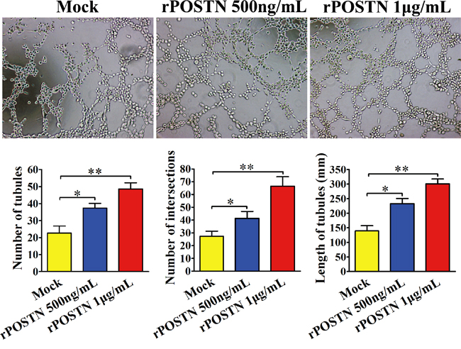 Effect of POSTN on tubule formation in vitro.