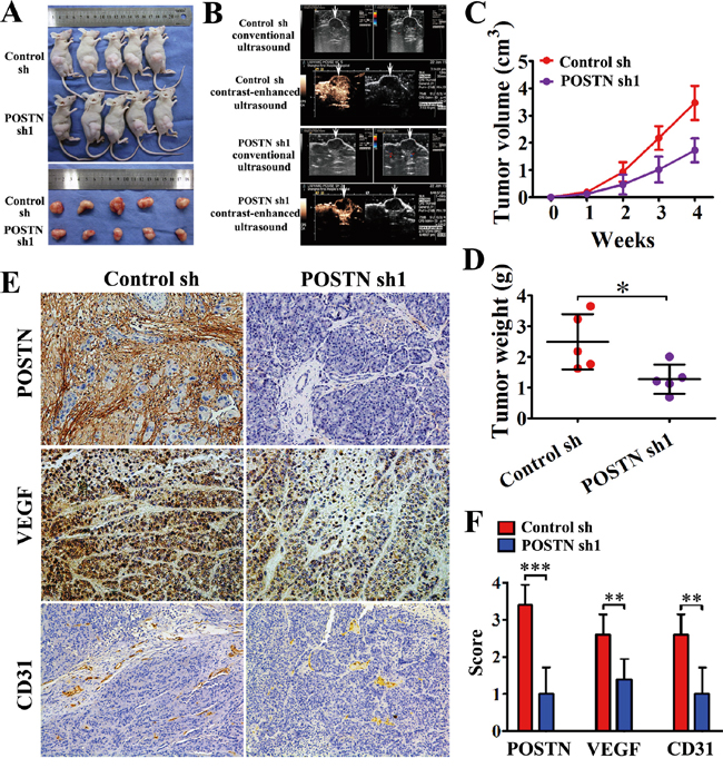 POSTN enhances the tumorigenicity and angiogenesis of pancreatic cancer cells in vivo.