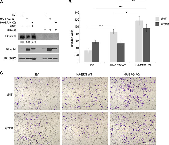 Acetylation-mimic ERG increases prostatic cell invasion.