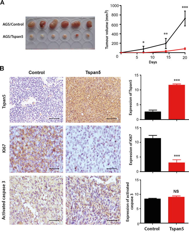 Tspan5 suppressed tumour growth of GC in vivo.
