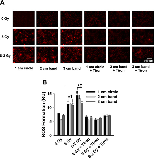 Intracellular ROS formation at 24 h after irradiation detected by DHE/ET fluorescence; data were measured from three randomly selected areas of 300&#x2013;500 cells in 1 cm circle, 2 and 3 cm bands, respectively; 0 Gy &#x00B1; Tiron vs.