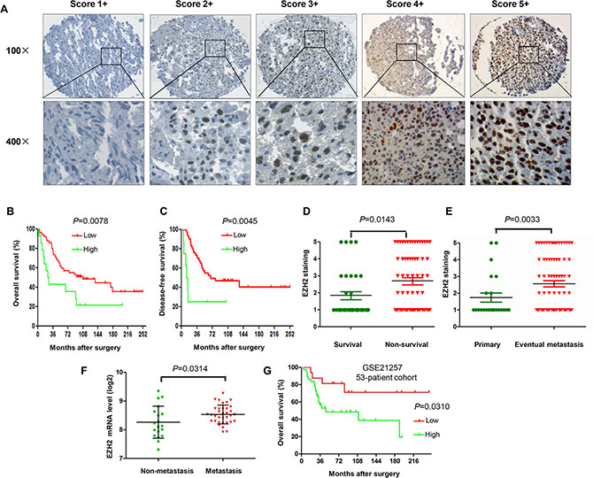 Association of EZH2 protein expression and clinical outcome in osteosarcoma patients.