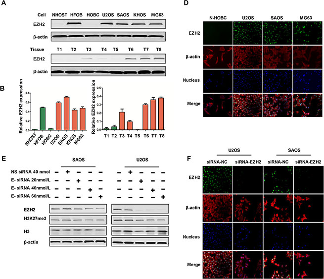 Expression of EZH2 in osteosarcoma cell lines and tissues, and effects of EZH2 knockdown by siRNA in osteosarcoma cell lines.