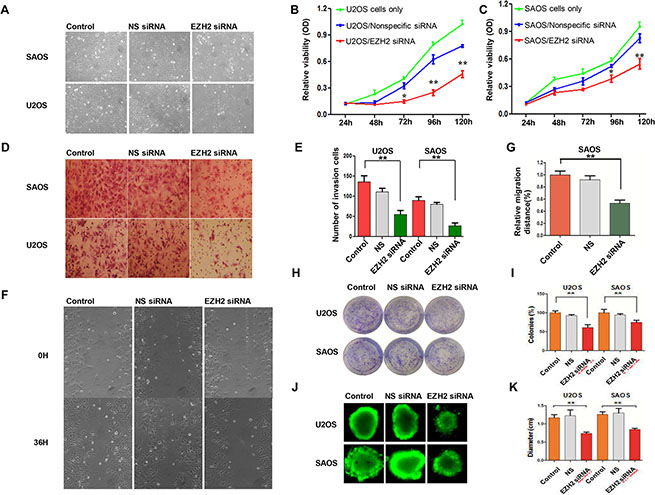 Effects of EZH2 silencing on osteosarcoma cell proliferation, migration, and invasion.