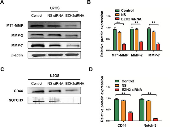 Effects of EZH2 silencing on the expression of metastasis-associated proteins and stem cell markers in osteosarcoma cell lines.