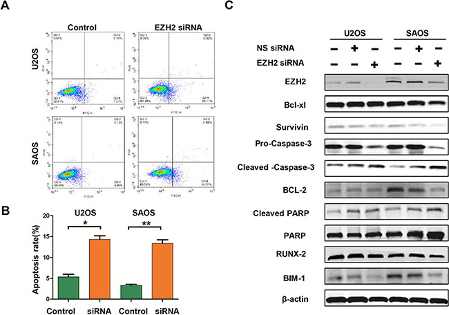 Effects of EZH2 silencing on apoptosis in osteosarcoma cells.