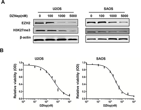 Effects of EZH2 inhibitor DZNep on the expression of EZH2 and cell growth in osteosarcoma cell lines.