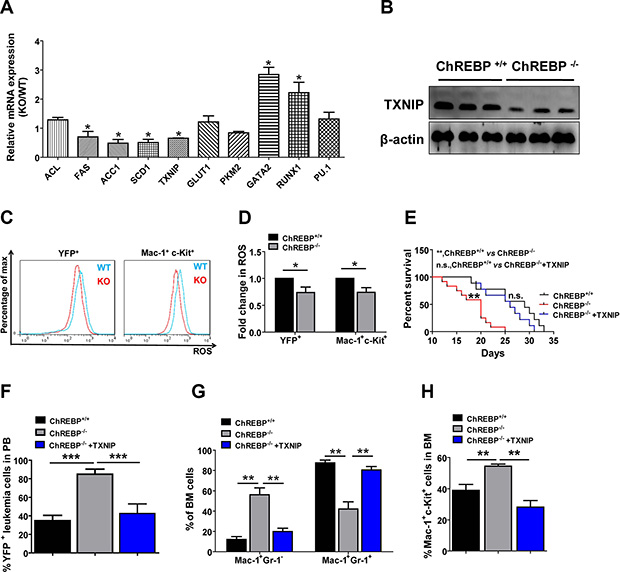 ChREBP controls the differentiation of LICs through TXNIP.