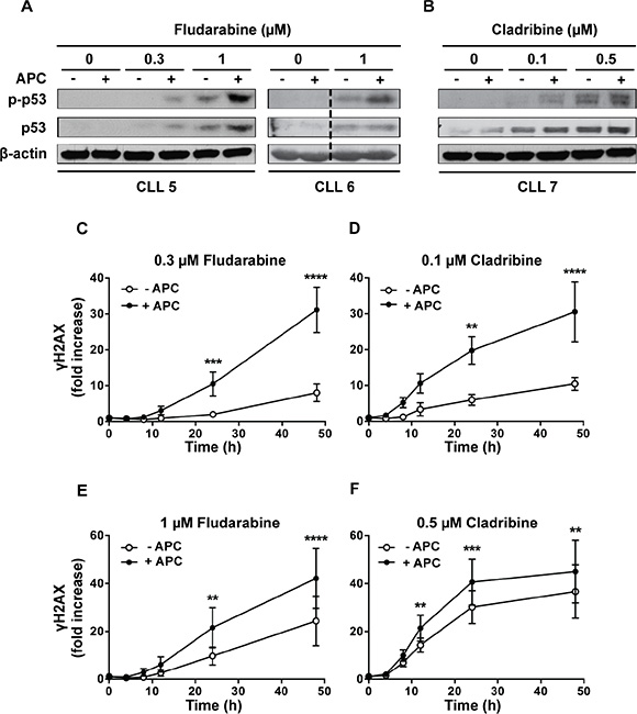 Effect of aphidicolin on p53 phosphorylation and &#x03B3;H2AX accumulation induced by purine analogs.