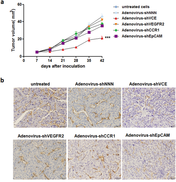Adenovirus-shVCE inhibited tumor growth and angiogenesis in NOD-SCID mice.