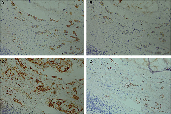 Immunohistochemical staining presented side-by-side on the same tissue (&#x00D7;200).