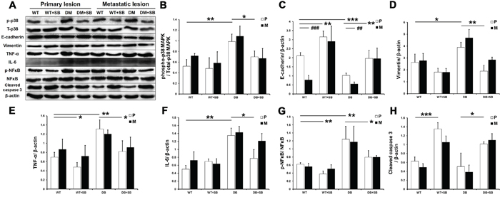 SB203580 inhibits EMT and the expression of inflammatory factors in diabetic pancreatic cancer in vivo.