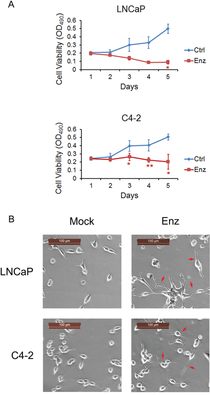 Enzalutamide treatment promotes cytotoxic effect on LNCaP cells and cytostatic effect on C4-2 cells along with morphological changes.