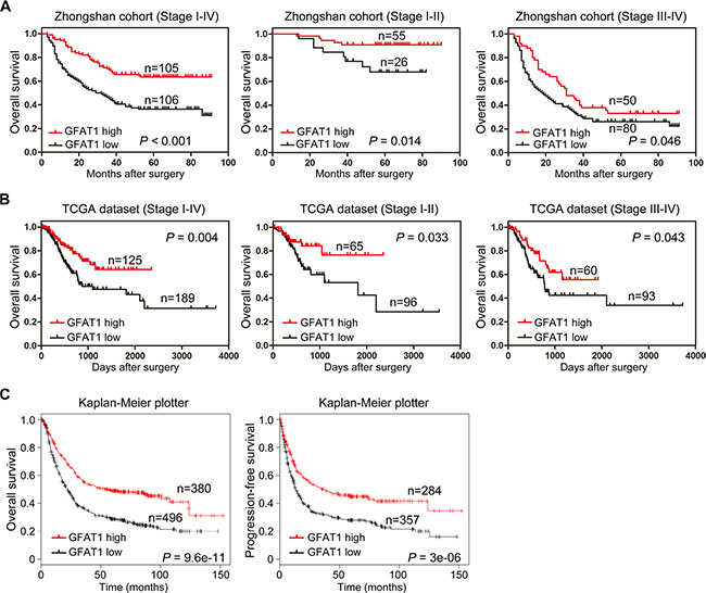 Kaplan-Meier survival analysis for overall survival of gastric cancer patients according to the GFAT1 expression.