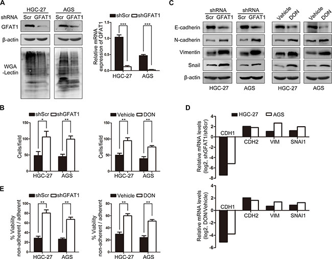 GFAT1 suppresses epithelial-to-mesenchymal transition and invasive activities in gastric cancer cells.