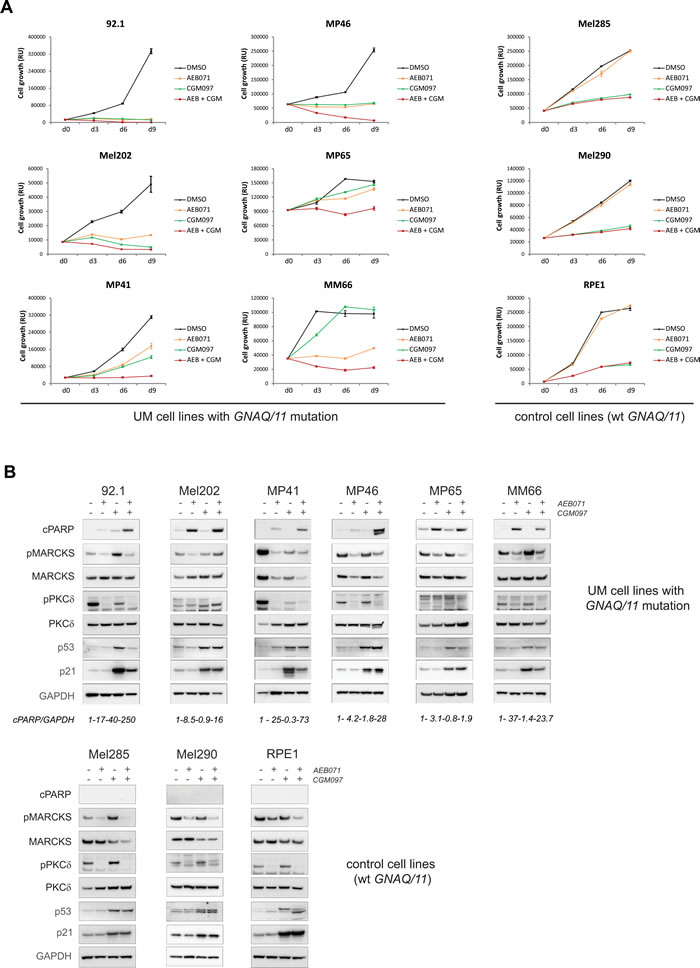 Co-inhibition of PKC and MDM2 induces cell death in the majority of UM cell lines.