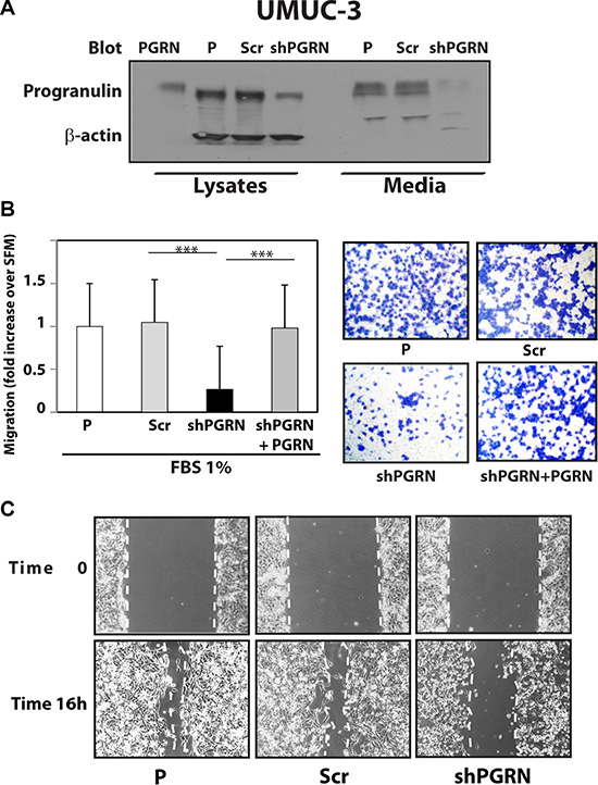 Progranulin depletion inhibits UMUC-3 urothelial cancer cell motility.