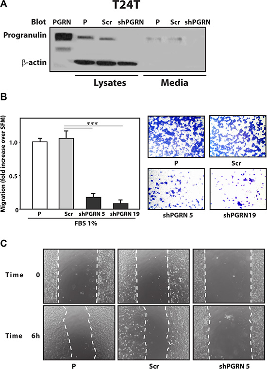 Progranulin depletion inhibits T24T urothelial cancer cell motility.