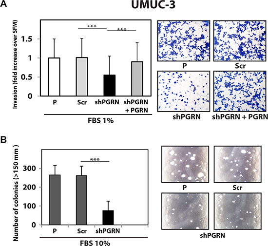 Progranulin targeting modulates invasion and anchorage-independent growth of UMUC-3 urothelial cancer cells.