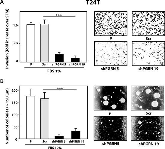 Progranulin targeting modulates invasion and anchorage-independent growth of T24T urothelial cancer cells.