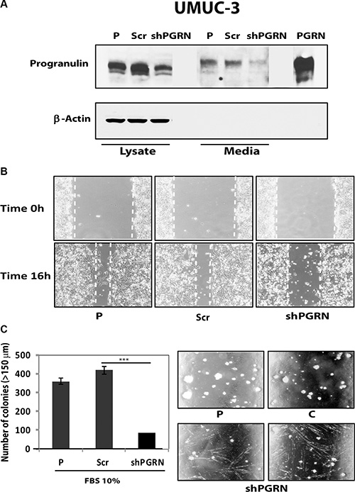 Progranulin depletion inhibits UMUC-3 urothelial cancer cell motility and anchorage-independent growth.