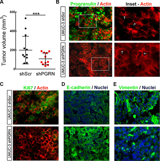 Progranulin regulates orthotopic bladder tumor formation.