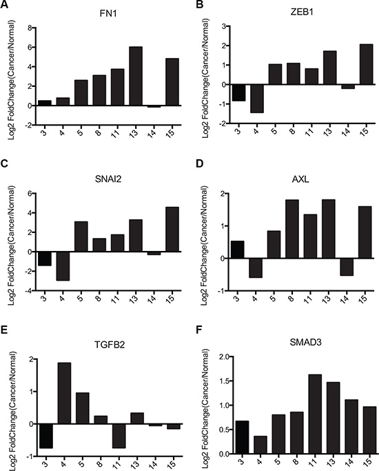 Pancreatic cancer samples exhibit similar FRA1:EMT signature as colorectal cancer cells.