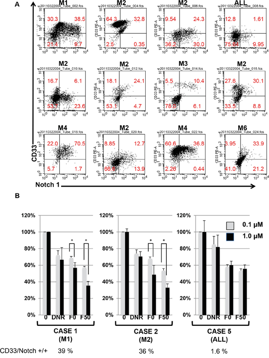 Effect of Fuc-liposome-daunorubicin on the growth of leukemia cells from patients.