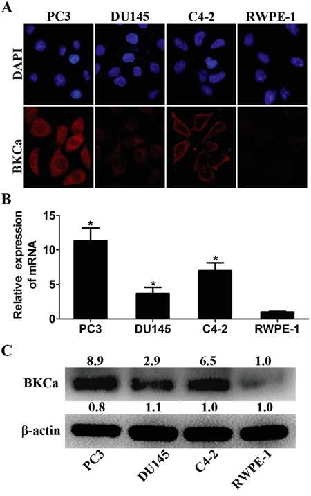 Expression analysis of BKCa in prostate cell lines.