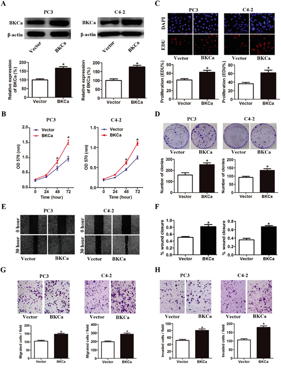 Overexpression of BKCa stimulates prostate cancer cell proliferation, migration and invasion.