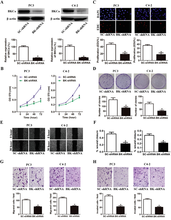 Downregulation of BKCa inhibits prostate cancer cell proliferation, migration and invasion.