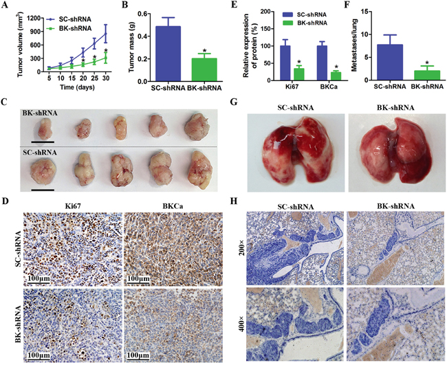 Downregulation of BKCa inhibits prostate cancer growth and metastasis in vivo.